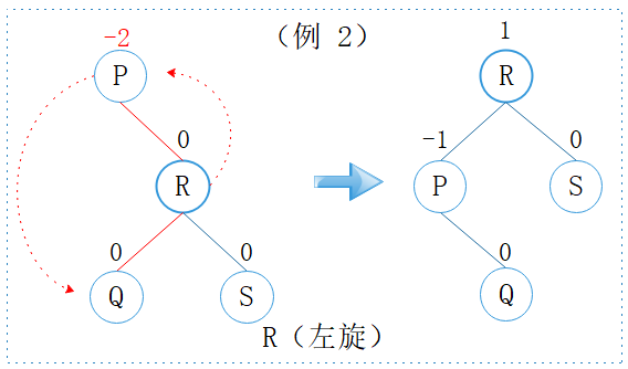 R型